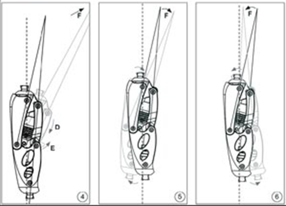 Prosthesis