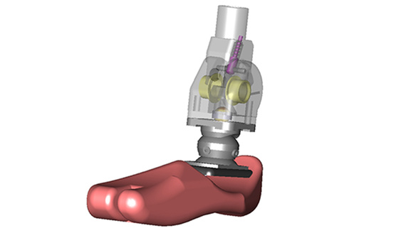 Prosthetic joint